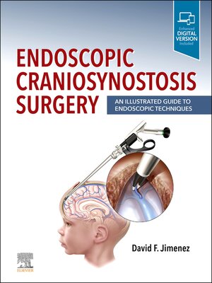 cover image of Endoscopic Craniosynostosis Surgery E-Book